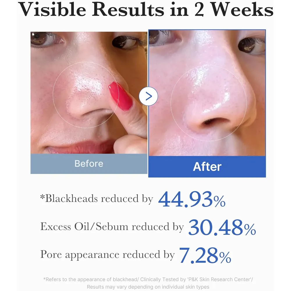 b09v7z4tjg_4_webp.webp Medicube Zero Pore 2.0 almohadillas exfoliantes AHA/BHA 70 unidades