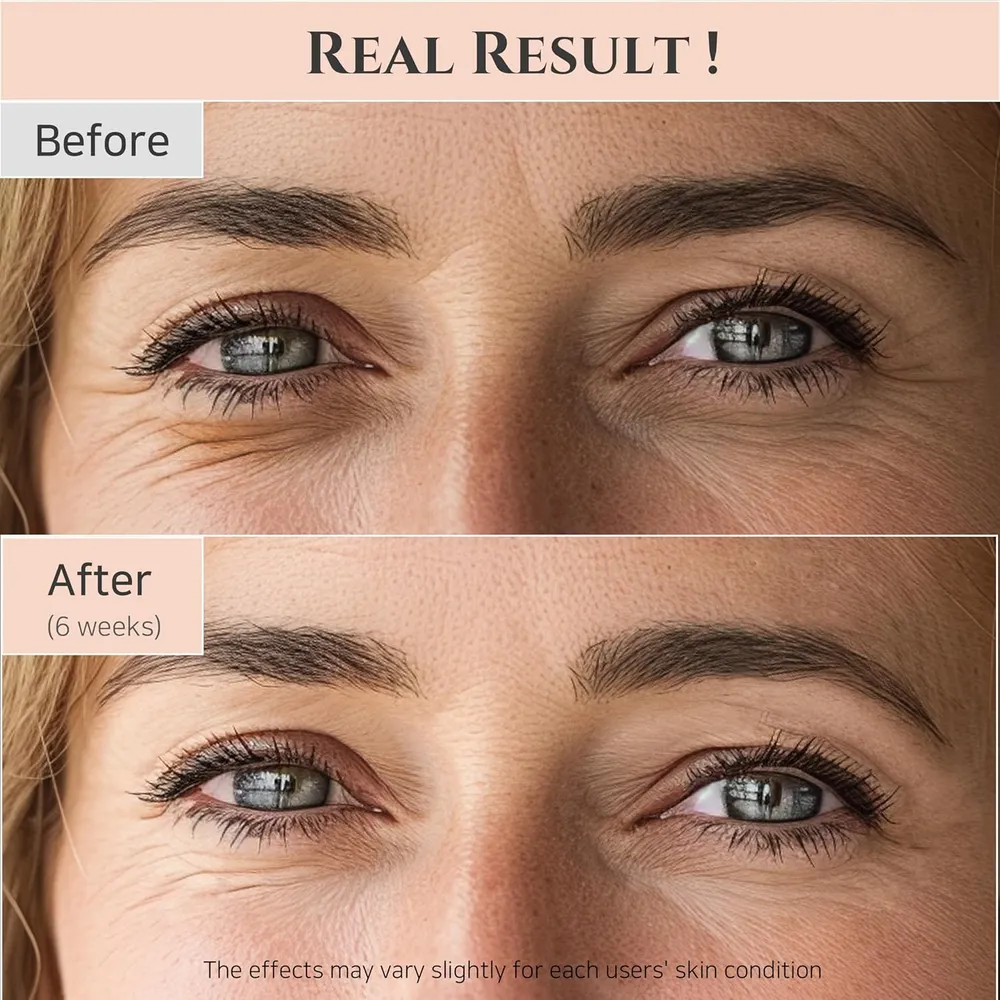 Beauty of Joseon | Sérum para Ojos Revive con Niacinamida y Retinol