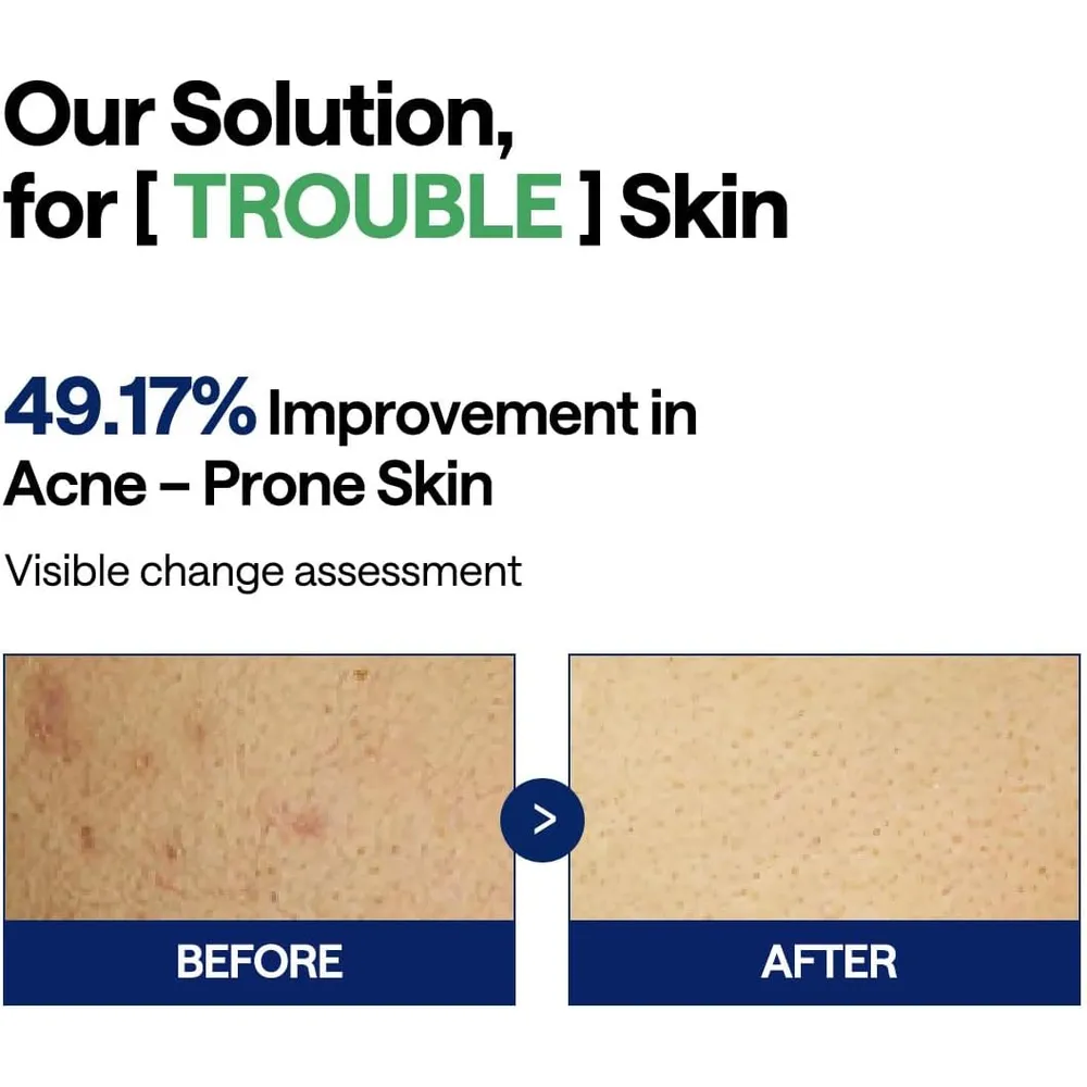 Mediheal Teatree Trouble Pad 100 uds