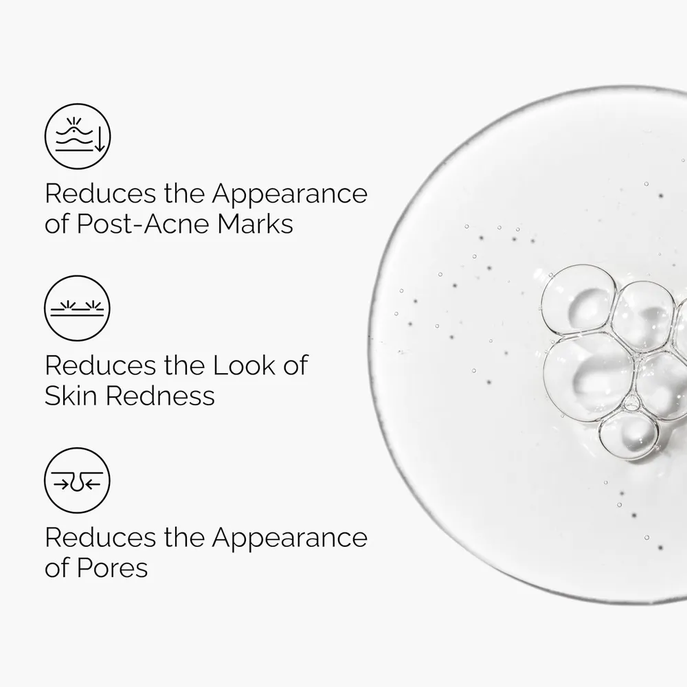 b0c24whn1r_2_webp.webp The Ordinary solución Aloe 2% + NAG 2% calmante y reparadora post-acné | 30 ml.