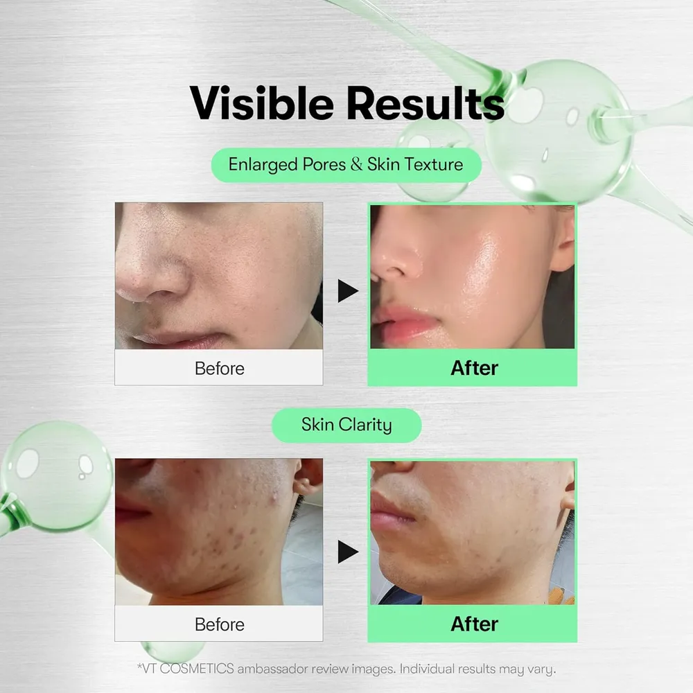 VT Cosmetics Cica Reedle Shot 100 Suero de Microagujas 50ml