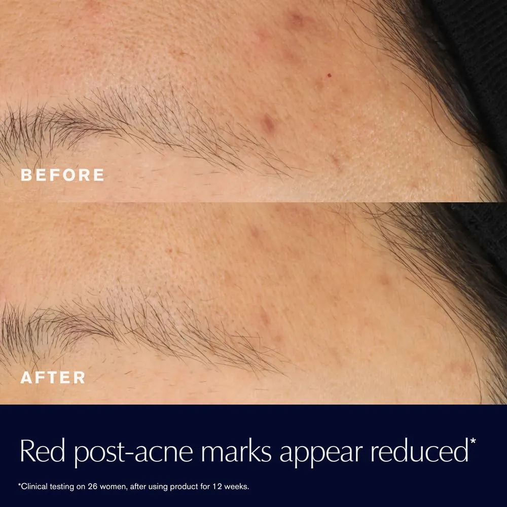 Estée Lauder Advanced Night Repair – Suero Reparador con 15% Fermento Bifido