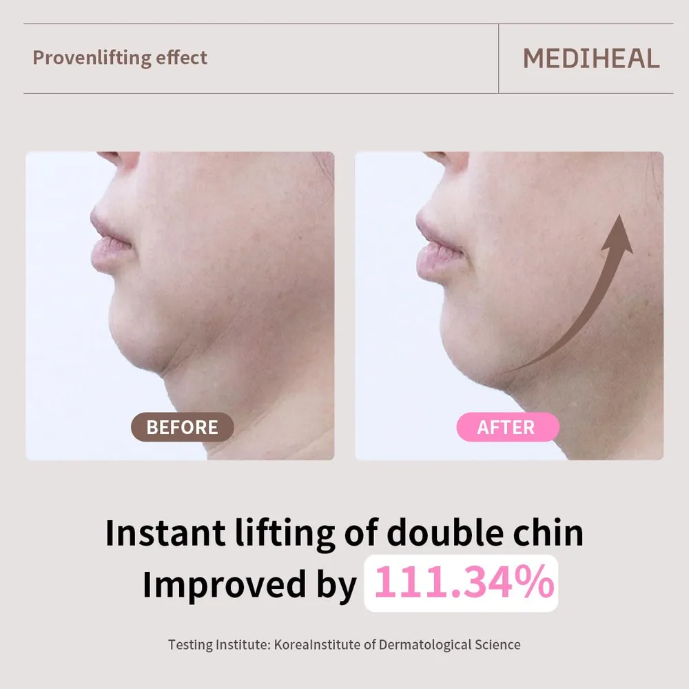 Mediheal Mascarilla Reafirmante con Colágeno y Retinol 10 uds