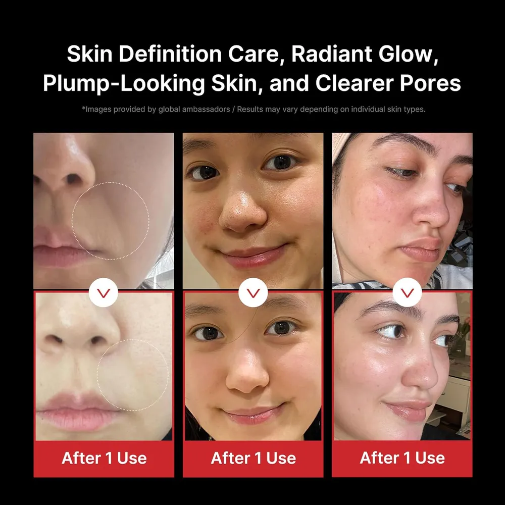 Medicube Age-R Booster Pro masajeador belleza 6 en 1 | Multicolor