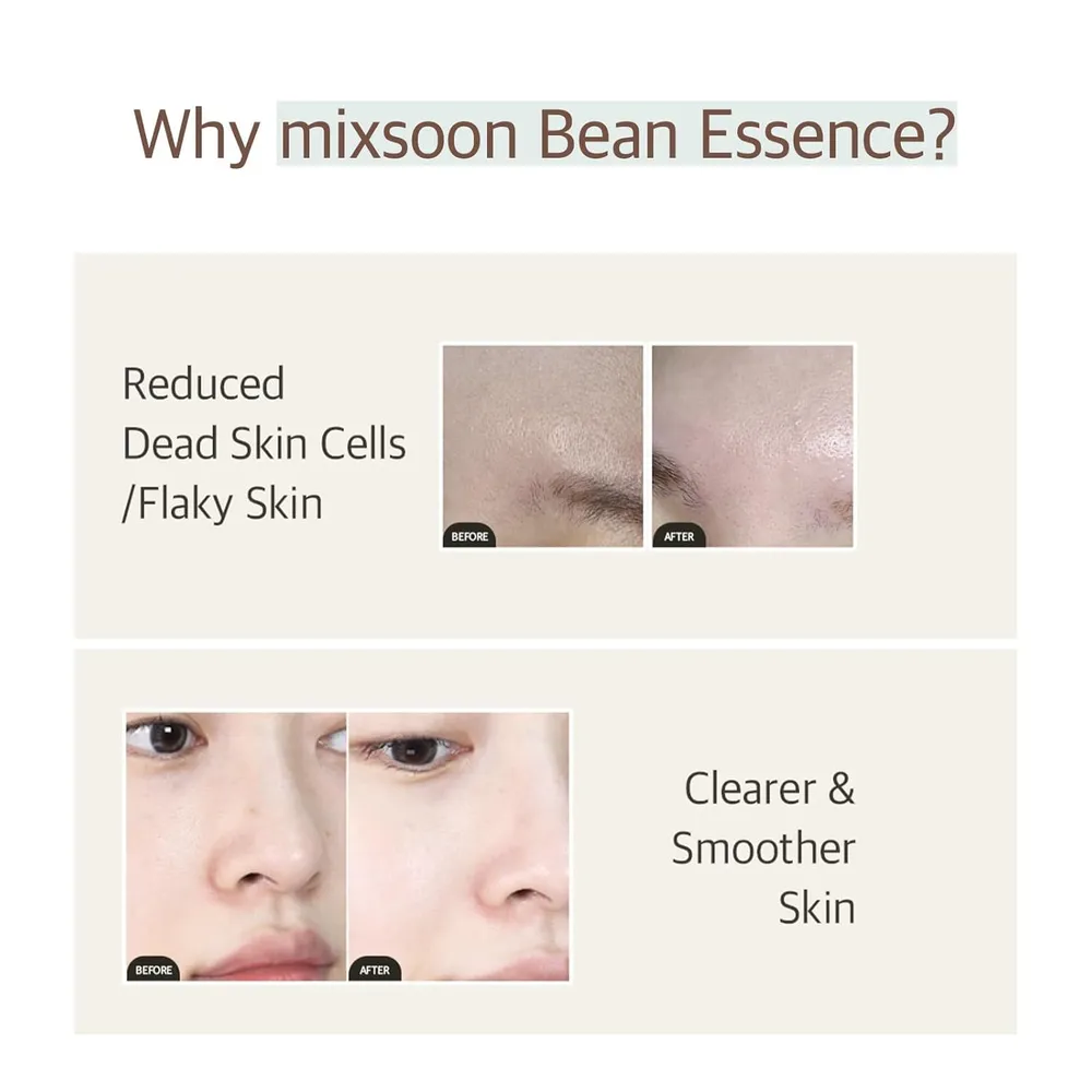 Mixsoon Bundle Esencia Bean 30 ml + Sérum Glaciar 300 ml – Korea Skin Care