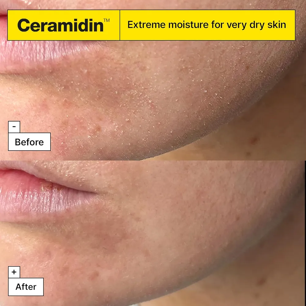 Dr. Jart+ Ceramidin Crema Hidratante Facial 50 ml