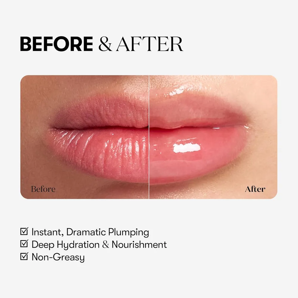 VT Cosmetics Reedle Shot Rellenador de Labios Transparente 4.3g