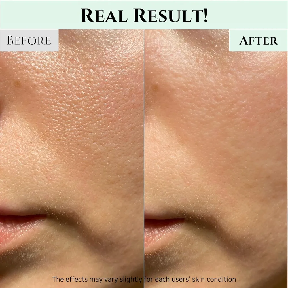 Beauty of Joseon | Set Limpiador en Gel Green Plum + Bálsamo Limpiador Radiance