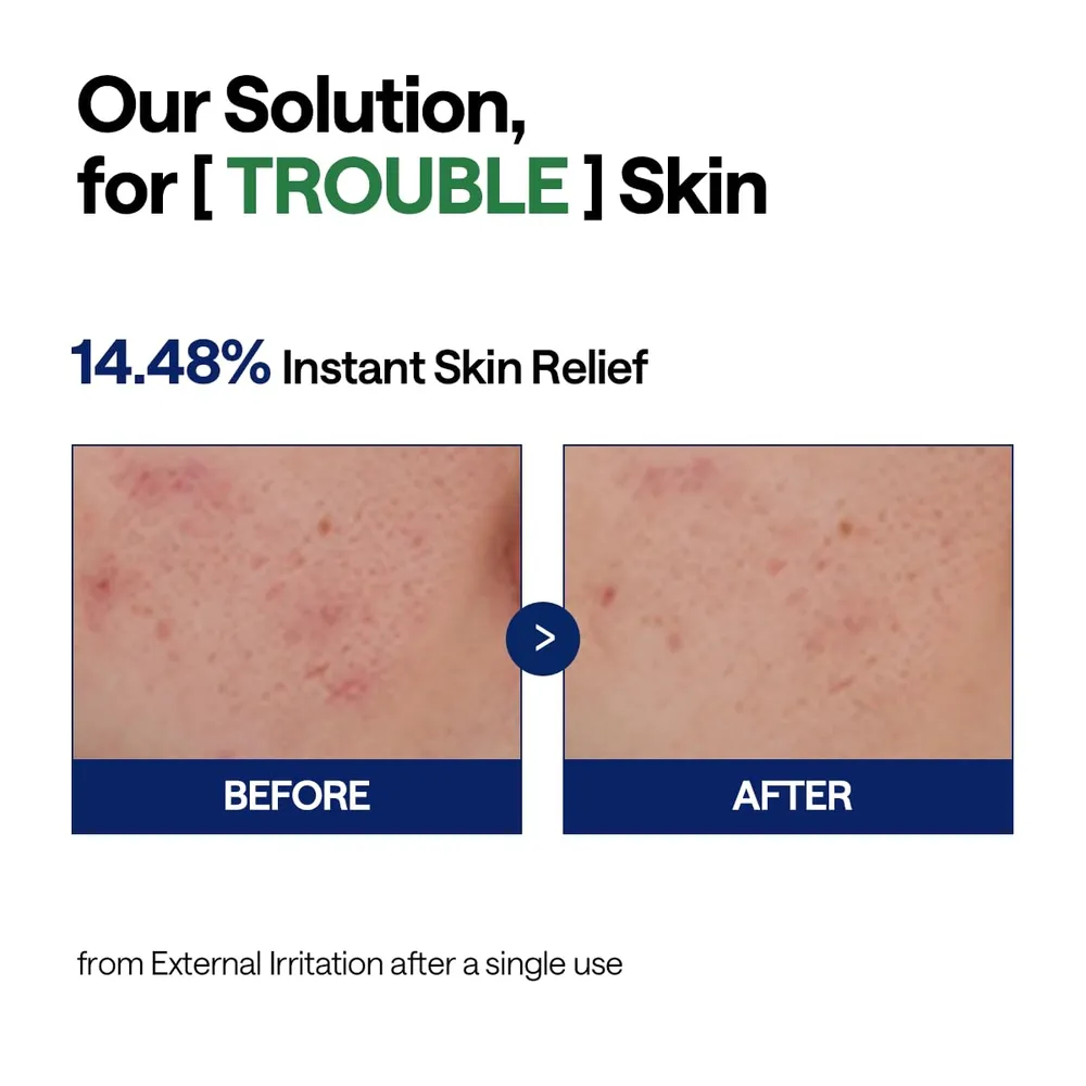 Mediheal Suero Calmante Árbol de Té 40 ml
