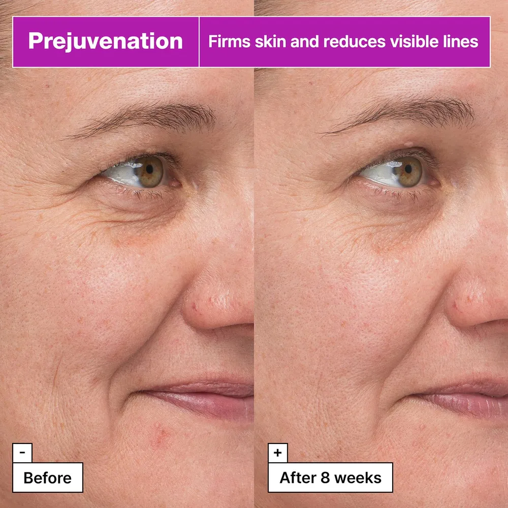 Dr. Jart+ Prejuvenation Suero Reafirmante con Bakuchiol y Péptidos 50 ml