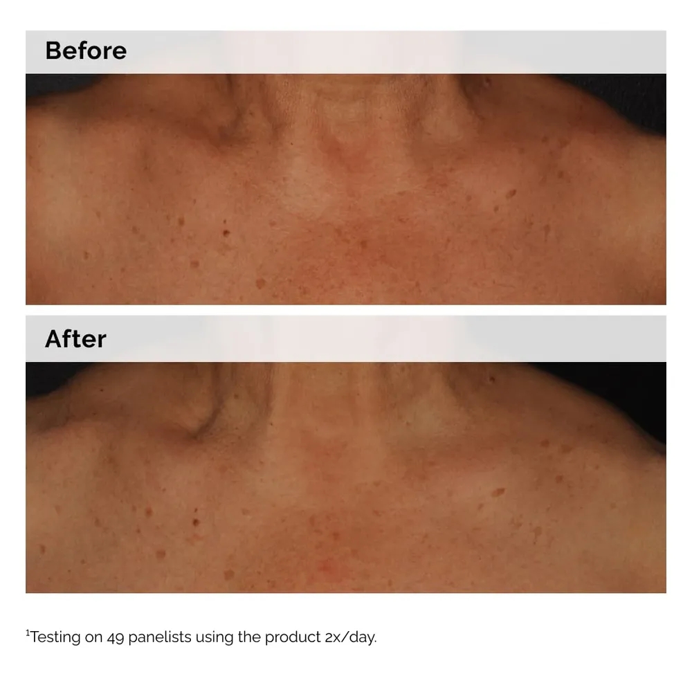 THE ORDINARY NIACINAMIDA 5% EMULSIÓN | 3.4 OZ / 100 ML