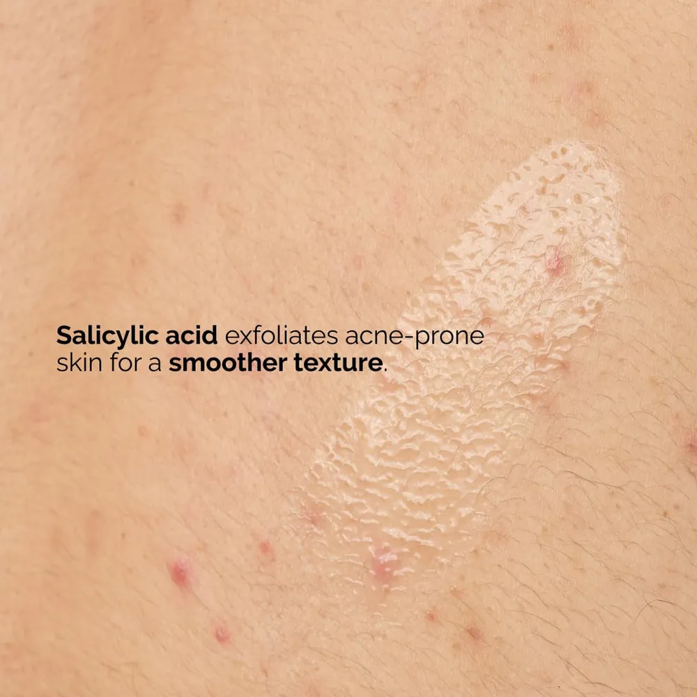 THE ORDINARY SUERO CORPORAL ÁCIDO SALICÍLICO 0.5% | 8.1 OZ / 240 ML