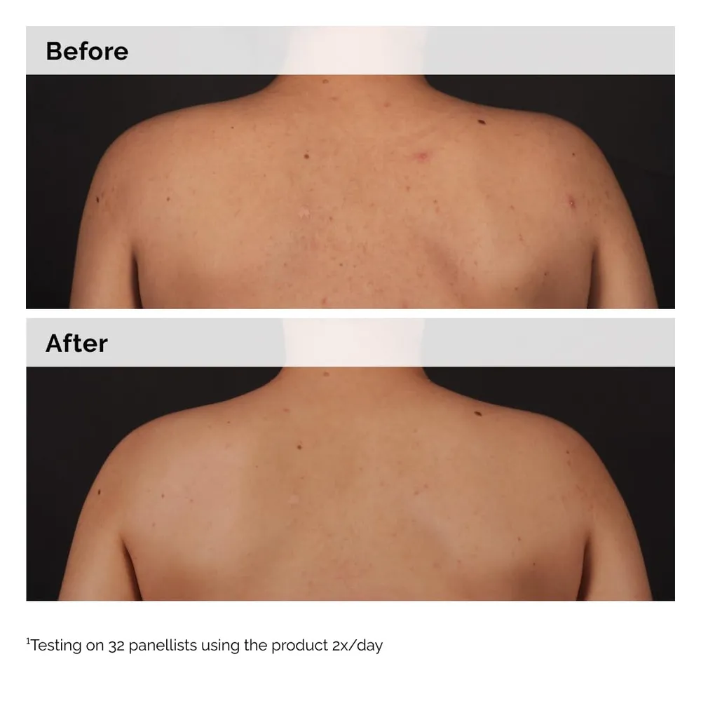 THE ORDINARY SUERO CORPORAL ÁCIDO SALICÍLICO 0.5% | 8.1 OZ / 240 ML