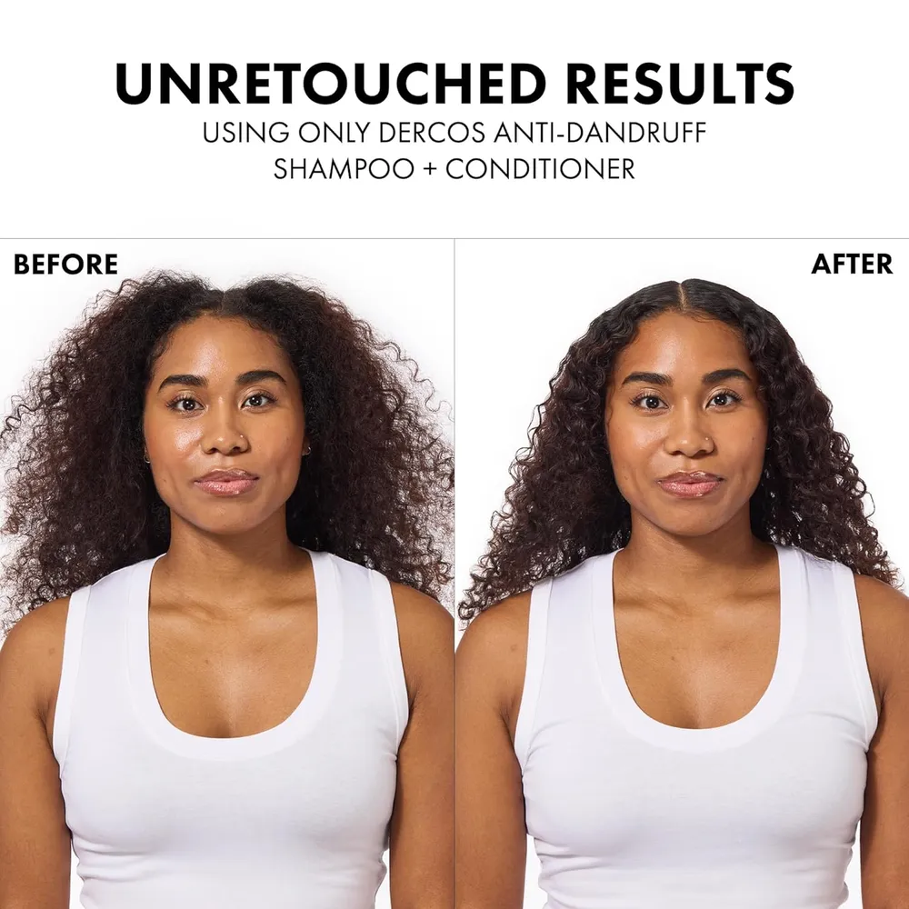 SET CHAMPÚ ANTICASPA & ACONDICIONADOR VICHY DERCOS 200 ML 2PZS