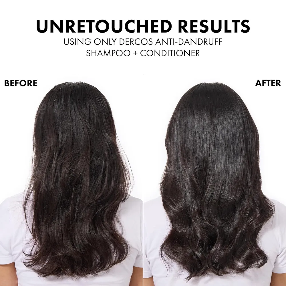 SET CHAMPÚ ANTICASPA & ACONDICIONADOR VICHY DERCOS 200 ML 2PZS