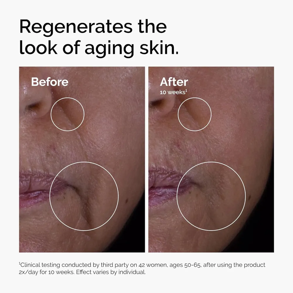 THE ORDINARY SOLUCIÓN GF 15% ANTI-AGING | 1 OZ / 30 ML