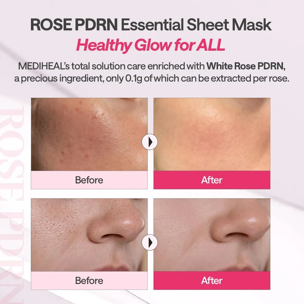 b0dwx8n3ml_5_webp.webp Mediheal Mascarilla Esencial Rose PDRN 10 uds