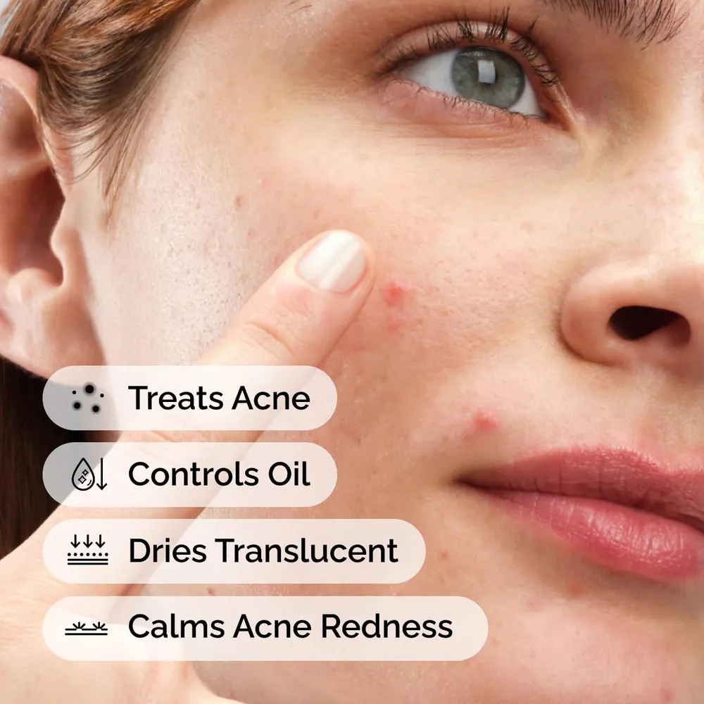 THE ORDINARY TRATAMIENTO ANTIACNÉ SULFUR 10% | 0.18 OZ / 5 ML
