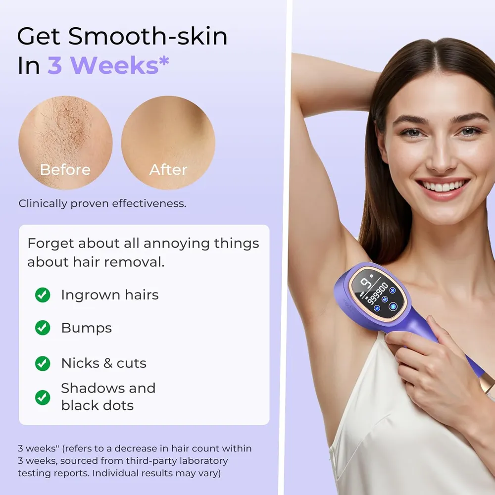 Depiladora láser IPL con contacto enfriamiento hielo Ubroo | Oro / Morado