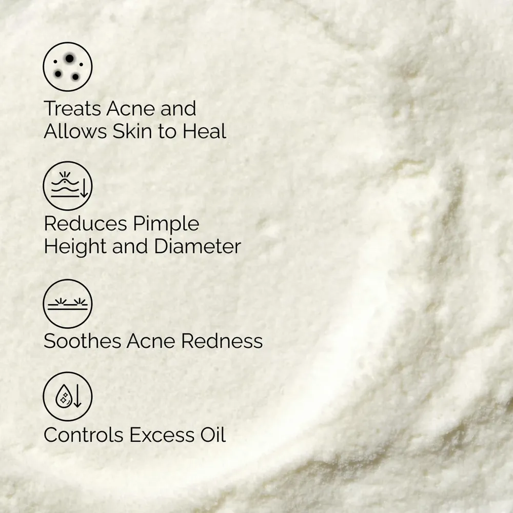 SET THE ORDINARY TRATAMIENTO ANTIACNÉ SULFUR 10%
