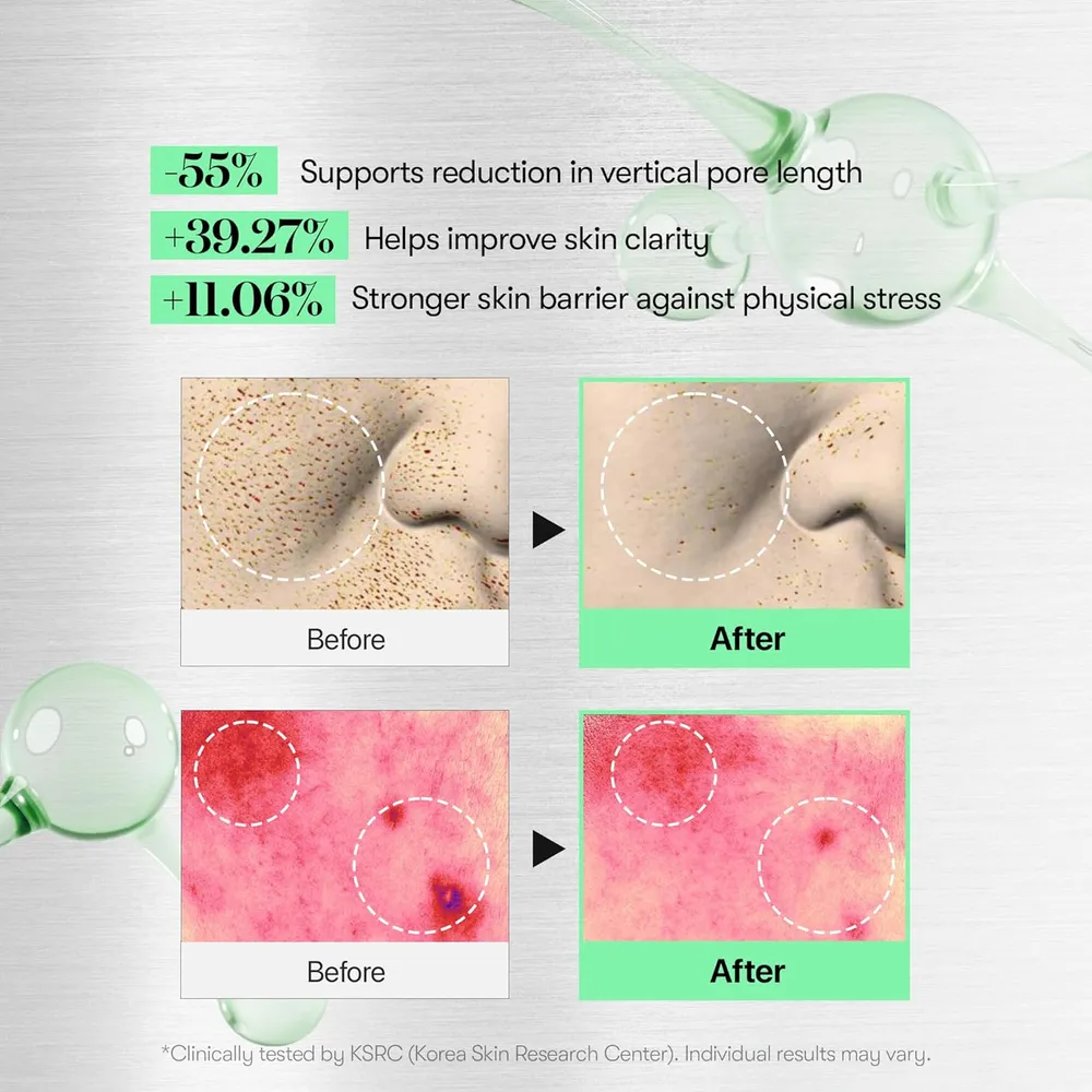 VT Cosmetics Cica Reedle Shot 100 + Crema en Cápsulas PDRN