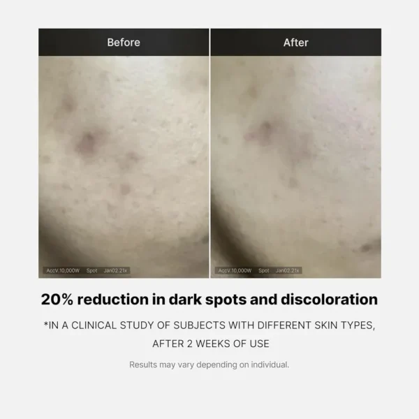SET SUERO MEDICUBE DEEP VITA C SERUM 2.0 - 3 PZS