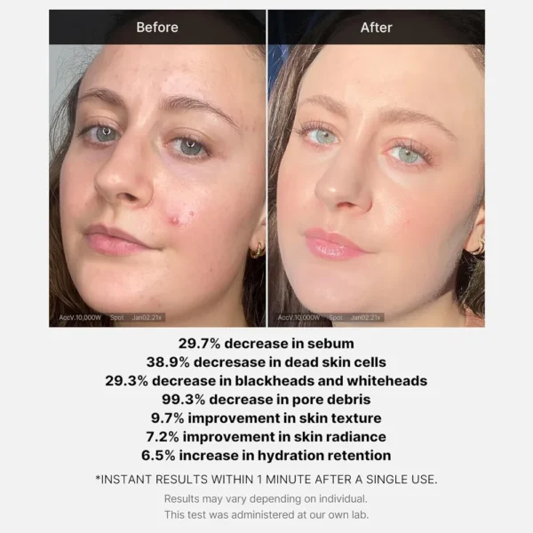 EXFOLIANTE MEDICUBE 21% ACID SERUM 1.38 OZ / 41 ML