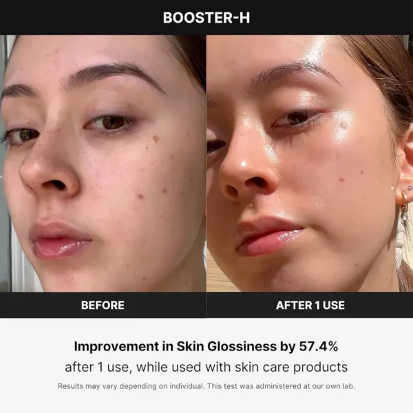 MEDICUBE BOOSTER H BEAUTY DEVICE