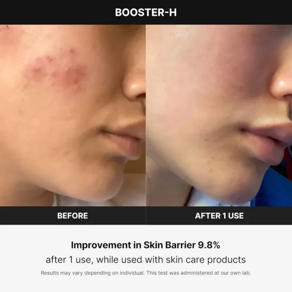 MEDICUBE BOOSTER H BEAUTY DEVICE