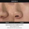 MEDICUBE BOOSTER H BEAUTY DEVICE
