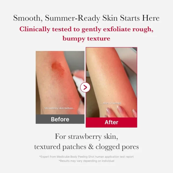 SPRAY CORPORAL MEDICUBE RED BODY PEELING SHOT 3.7 OZ / 110 ML