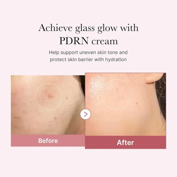 b0dknnygnv_2_webp.webp CREMA HIDRATANTE MEDICUBE PDRN PINK HYALURONIC MOISTURIZER 1.7 OZ / 50 ML
