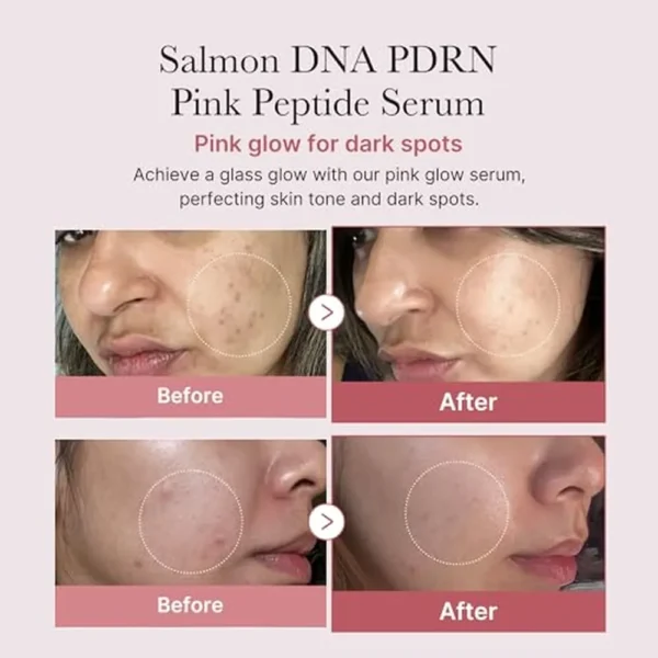 b0dxsm5ktw_1_webp.webp SET MEDICUBE SALMON DNA PDRN PINK PEPTIDE + ONE DAY AMPOULE 10 PZS