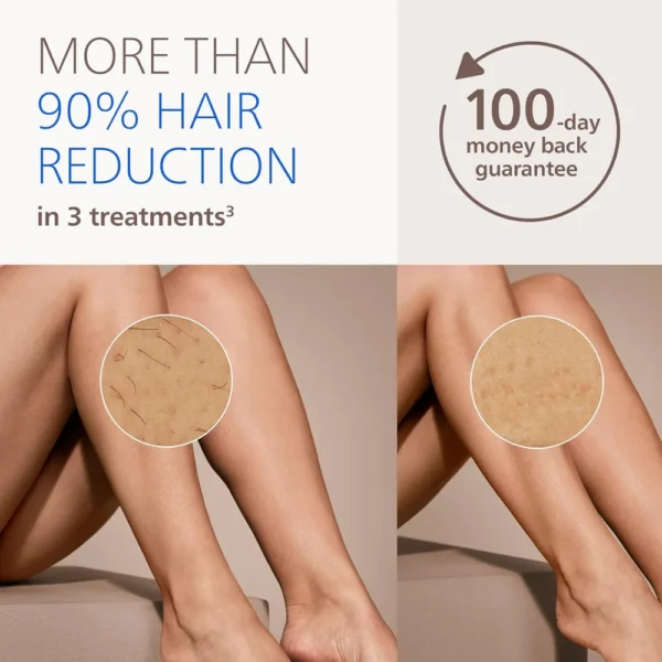DEPILADORA IPL PHILIPS LUMEA SERIES 9000 BRI984/03
