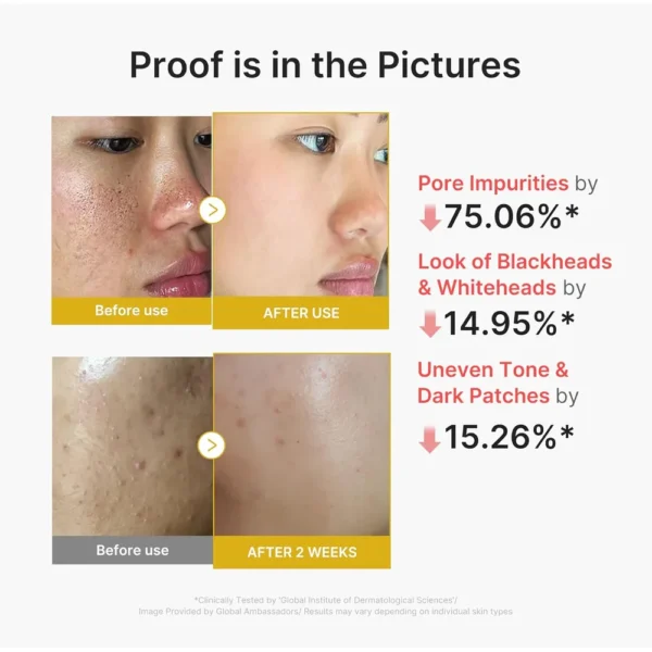 PEELING MEDICUBE ACIDO KOJICO Y CURCUMA 2.70 OZ / 80 ML