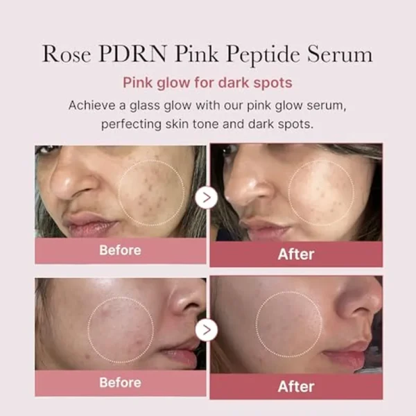 SET SERUMS VIRALES MEDICUBE PIEL CLARA Y TERSA 1 OZ / 30 ML 2 PZS