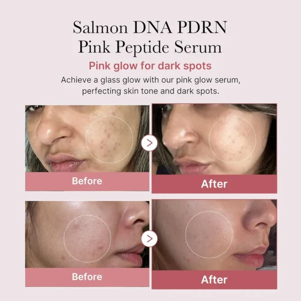 SET SERUM PEPTIDOS MEDICUBE PDRN ROSTRO Y OJOS 2 PZS