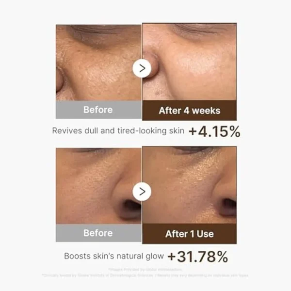 SET MEDICUBE DEEP VITA C RADIANCE PAD & SERUM 2 PZS