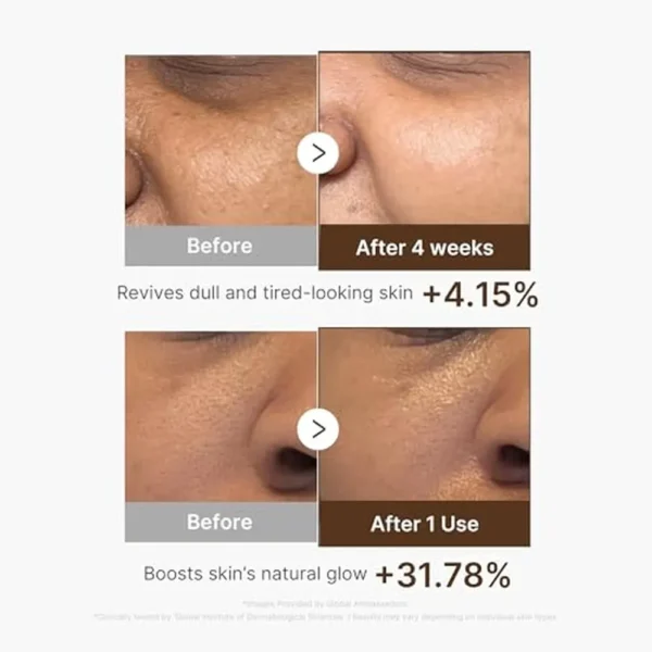SET SERUM Y CREMA CAPSULAS VITAMINA C PROFUNDA MEDICUBE 2 PZS