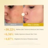 SET FACIAL MEDICUBE CON ÁCIDO KÓJICO, CÚRCUMA Y EXFOLIANTE 2 PZS